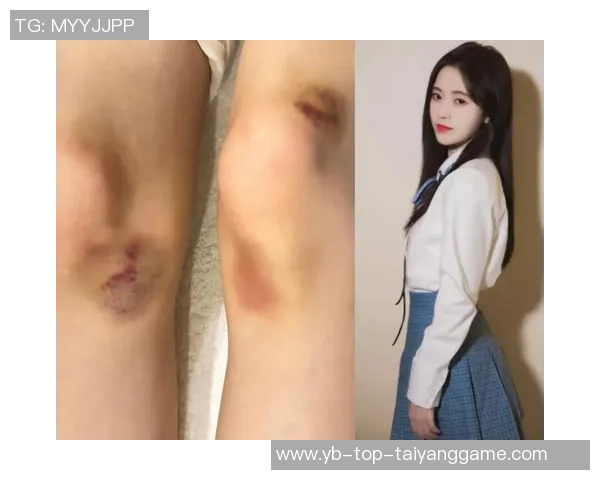 小波特透露膝盖内侧副韧带轻微扭伤正在恢复中感到酸痛逐渐减轻